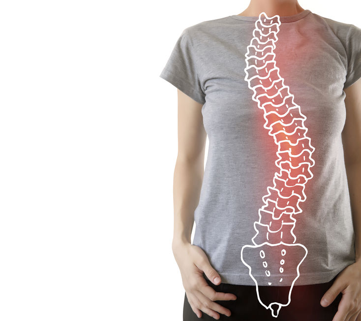 How To Fix Scoliosis Naturally Maxliving