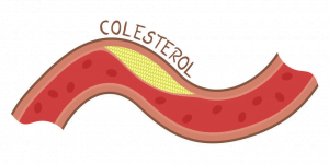 measuring cholesterol levels