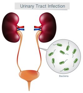 what is a urinary tract infection (UTI)